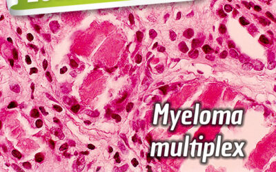 Myeloma Multiplex és a BioBran – 2013